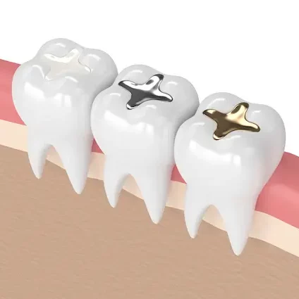 Smile Dental Clinic: Dental Restoration Dentist Dr. Ana Fusu Dr. Fusu